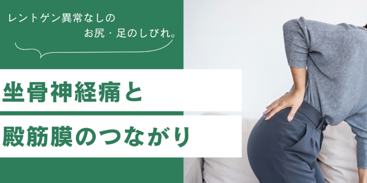 坐骨神経痛と筋膜